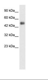 GCM1 Antibody - Placenta Lysate.  This image was taken for the unconjugated form of this product. Other forms have not been tested.