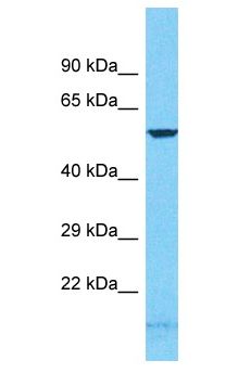 GCM2 Antibody - GCM2 antibody Western Blot of HeLa. Antibody dilution: 1 ug/ml.  This image was taken for the unconjugated form of this product. Other forms have not been tested.