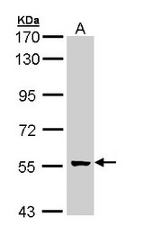 GCM2 Antibody - Sample (30 ug of whole cell lysate). A: A431 . 7.5% SDS PAGE. GCM2 antibody diluted at 1:1000.