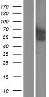 GCM2 Protein - Western validation with an anti-DDK antibody * L: Control HEK293 lysate R: Over-expression lysate