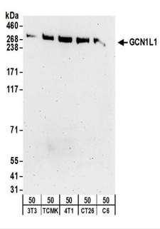 GCN1 / GCN1L1 Antibody - Detection of Mouse and Rat GCN1L1 by Western Blot. Samples: Whole cell lysate (50 ug) from NIH3T3, TCMK-1, 4T1, CT26.WT, and rat C6 cells. Antibodies: Affinity purified rabbit anti-GCN1L1 antibody used for WB at 0.5 ug/ml. Detection: Chemiluminescence with an exposure time of 3 minutes.