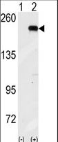GCN2 Antibody - Western blot of GCN2 (arrow) using GCN2 Antibody (N-term G11). 293 cell lysates (2 ug/lane) either nontransfected (Lane 1) or transiently transfected with the GCN2 gene (Lane 2) (Origene Technologies).