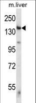 GCN2 Antibody - Mouse Eif2ak4 Antibody western blot of mouse liver tissue lysates (35 ug/lane). The Eif2ak4 antibody detected the Eif2ak4 protein (arrow).