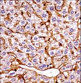 GCN2 Antibody - Mouse Eif2ak4 Antibody immunohistochemistry of formalin-fixed and paraffin-embedded mouse live tissue followed by peroxidase-conjugated secondary antibody and DAB staining.This data demonstrates the use of Mouse Eif2ak4 Antibody for immunohistochemistry.