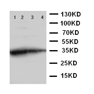 GCN2 Antibody - WB of GCN2 antibody. Recombinant Protein Detection Source:. E.coli derived -recombinant Mouse EIF2AK4, 35.3KD. (162aa tag+ E801-R954). . Lane 1: Recombinant Mouse EIF2AK4 Protein 10ng. Lane 2: Recombinant Mouse EIF2AK4 Protein 5ng. Lane 3: Recombinant Mouse EIF2AK4 Protein 2.5ng..