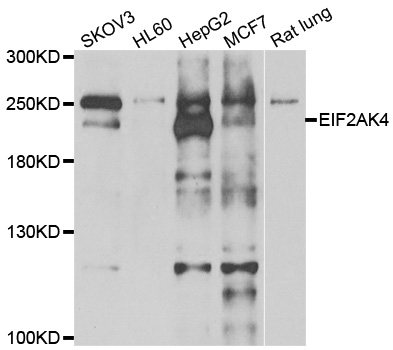 GCN2 Antibody - Western blot analysis of extracts of various cell lines.