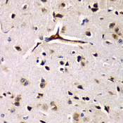 GCN2 Antibody - Immunohistochemistry of paraffin-embedded rat brain tissue.