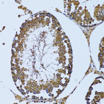 GCN2 Antibody - Immunohistochemistry of paraffin-embedded mouse testis using EIF2AK4 antibody at dilution of 1:100 (20x lens).