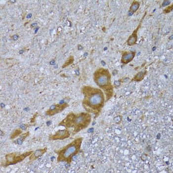 GCN2 Antibody - Immunohistochemistry of paraffin-embedded mouse spinal cord using EIF2AK4 antibody at dilution of 1:100 (40x lens).