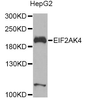 GCN2 Antibody - Western blot analysis of extracts of HepG2 cells, using EIF2AK4 Antibody at 1:1000 dilution. The secondary antibody used was an HRP Goat Anti-Rabbit IgG (H+L) at 1:10000 dilution. Lysates were loaded 25ug per lane and 3% nonfat dry milk in TBST was used for blocking. An ECL Kit was used for detection and the exposure time was 30s.