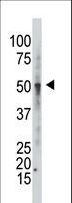 GCNT1 / C2GNT Antibody - Western blot of anti-GCNT1 Antibody in CEM cell line lysates (35 ug/lane). GCNT1 (arrow) was detected using the purified antibody.