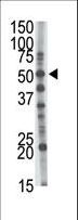 GCNT1 / C2GNT Antibody - The anti-GCNT1 antibody is used in Western blot to detect GCNT1 in mouse kidney tissue lysate.
