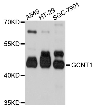 GCNT1 / C2GNT Antibody - Western blot analysis of extracts of various cell lines, using GCNT1 antibody at 1:1000 dilution. The secondary antibody used was an HRP Goat Anti-Rabbit IgG (H+L) at 1:10000 dilution. Lysates were loaded 25ug per lane and 3% nonfat dry milk in TBST was used for blocking. An ECL Kit was used for detection and the exposure time was 30s.