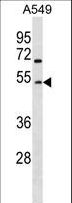 GCNT2 Antibody - GCNT2 Antibody western blot of A549 cell line lysates (35 ug/lane). The GCNT2 Antibody detected the GCNT2 protein (arrow).