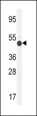 GCNT2 Antibody - GCNT2 Antibody western blot of mouse kidney tissue lysates (35 ug/lane). The GCNT2 antibody detected the GCNT2 protein (arrow).