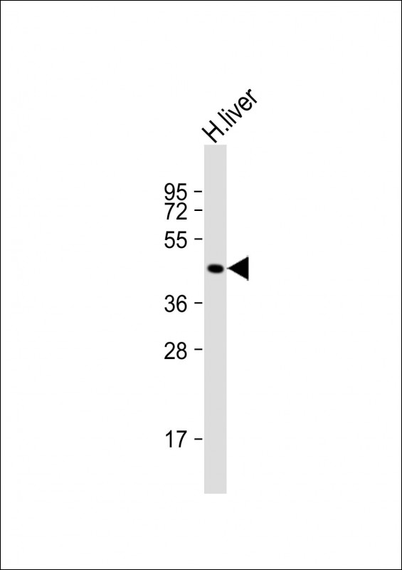 GCNT2 Antibody - Anti-GCNT2 Antibody (Center) at 1:1000 dilution + human liver lysate Lysates/proteins at 20 µg per lane. Secondary Goat Anti-Rabbit IgG, (H+L), Peroxidase conjugated at 1/10000 dilution. Predicted band size: 47 kDa Blocking/Dilution buffer: 5% NFDM/TBST.