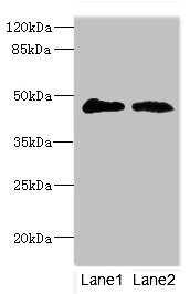 GCNT2 Antibody - Western blot All Lanes:GCNT2 antibody at 3.99ug/ml Lane 1:293T whole cell lysate Lane 2:mouse placenta tissue Secondary Goat polyclonal to rabbit at 1/10000 dilution Predicted band size: 46,47 kDa Observed band size: 47 kDa