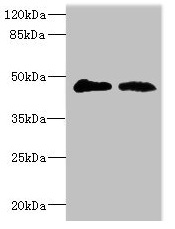 GCNT2 Antibody - Western blot All lanes: GCNT2 antibody at 3.99µg/ml Lane 1: 293T whole cell lysate Lane 2: Mouse placenta tissue Secondary Goat polyclonal to rabbit IgG at 1/10000 dilution Predicted band size: 46, 47 kDa Observed band size: 46 kDa