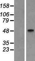 GCNT2 Protein - Western validation with an anti-DDK antibody * L: Control HEK293 lysate R: Over-expression lysate