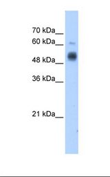 GCNT3 Antibody - Transfected 293T cell lysate. Antibody concentration: 1.25 ug/ml. Gel concentration: 12%.  This image was taken for the unconjugated form of this product. Other forms have not been tested.