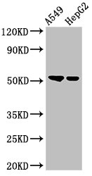 GCNT3 Antibody - Positive Western Blot detected in A549 whole cell lysate, HepG2 whole cell lysate. All lanes: GCNT3 antibody at 3 µg/ml Secondary Goat polyclonal to rabbit IgG at 1/50000 dilution. Predicted band size: 51 KDa. Observed band size: 51 KDa