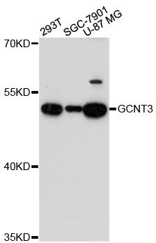 GCNT3 Antibody - Western blot analysis of extracts of various cell lines, using GCNT3 antibody at 1:3000 dilution. The secondary antibody used was an HRP Goat Anti-Rabbit IgG (H+L) at 1:10000 dilution. Lysates were loaded 25ug per lane and 3% nonfat dry milk in TBST was used for blocking. An ECL Kit was used for detection and the exposure time was 90s.