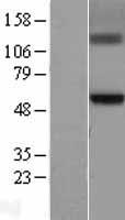 GCNT3 Protein - Western validation with an anti-DDK antibody * L: Control HEK293 lysate R: Over-expression lysate