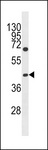 GCNT6 Antibody - GCNT6 Antibody western blot of Jurkat cell line lysates (35 ug/lane). The GCNT6 antibody detected the GCNT6 protein (arrow).