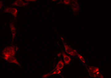 GCNT6 Antibody - Staining NIH-3T3 cells by IF/ICC. The samples were fixed with PFA and permeabilized in 0.1% Triton X-100, then blocked in 10% serum for 45 min at 25°C. The primary antibody was diluted at 1:200 and incubated with the sample for 1 hour at 37°C. An Alexa Fluor 594 conjugated goat anti-rabbit IgG (H+L) Ab, diluted at 1/600, was used as the secondary antibody.