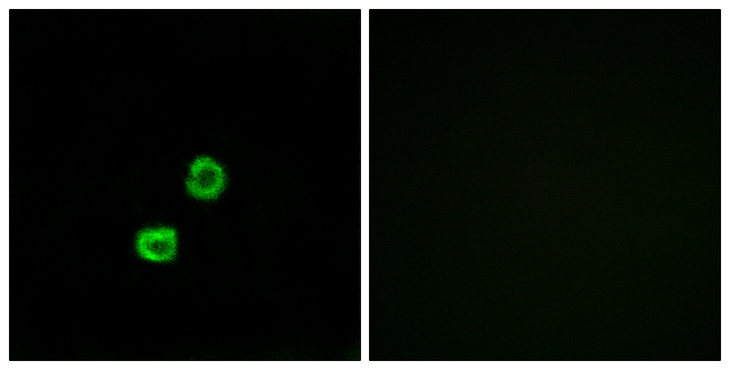 GCNT7 Antibody - Immunofluorescence analysis of MCF7 cells, using GCNT7 Antibody. The picture on the right is blocked with the synthesized peptide.