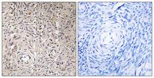 GCNT7 Antibody - Immunohistochemistry analysis of paraffin-embedded human ovary tissue, using GCNT7 Antibody. The picture on the right is blocked with the synthesized peptide.