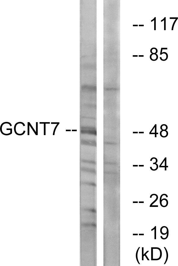 GCNT7 Antibody - Western blot analysis of lysates from K562 cells, using GCNT7 Antibody. The lane on the right is blocked with the synthesized peptide.