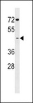GCNT7 Antibody - GCNT7 Antibody western blot of K562 cell line lysates (35 ug/lane). The GCNT7 antibody detected the GCNT7 protein (arrow).