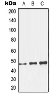 GCNT7 Antibody - Western blot analysis of GCNT7 expression in HeLa (A); mouse kidney (B); rat kidney (C) whole cell lysates.
