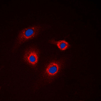 GCNT7 Antibody - Immunofluorescent analysis of GCNT7 staining in HeLa cells. Formalin-fixed cells were permeabilized with 0.1% Triton X-100 in TBS for 5-10 minutes and blocked with 3% BSA-PBS for 30 minutes at room temperature. Cells were probed with the primary antibody in 3% BSA-PBS and incubated overnight at 4 C in a humidified chamber. Cells were washed with PBST and incubated with a DyLight 594-conjugated secondary antibody (red) in PBS at room temperature in the dark. DAPI was used to stain the cell nuclei (blue).