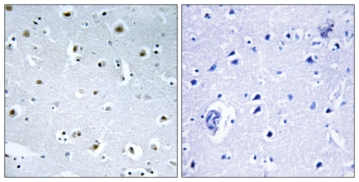 GCP3 / TUBGCP3 Antibody - Immunohistochemistry analysis of paraffin-embedded human brain tissue, using TUBGCP3 Antibody. The picture on the right is blocked with the synthesized peptide.