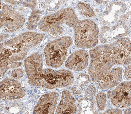 GCP3 / TUBGCP3 Antibody - 1:100 staining human kidney tissue by IHC-P. The tissue was formaldehyde fixed and a heat mediated antigen retrieval step in citrate buffer was performed. The tissue was then blocked and incubated with the antibody for 1.5 hours at 22°C. An HRP conjugated goat anti-rabbit antibody was used as the secondary.