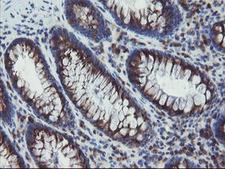 GCP60 / ACBD3 Antibody - IHC of paraffin-embedded Human colon tissue using anti-ACBD3 mouse monoclonal antibody.