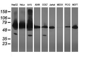 GCP60 / ACBD3 Antibody - Western blot of extracts (35 ug) from 9 different cell lines by using g anti-ACBD3 monoclonal antibody (HepG2: human; HeLa: human; SVT2: mouse; A549: human; COS7: monkey; Jurkat: human; MDCK: canine; PC12: rat; MCF7: human).