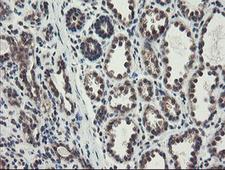GCP60 / ACBD3 Antibody - IHC of paraffin-embedded Human breast tissue using anti-ACBD3 mouse monoclonal antibody.