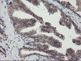 GCP60 / ACBD3 Antibody - IHC of paraffin-embedded Human prostate tissue using anti-ACBD3 mouse monoclonal antibody.