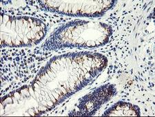 GCP60 / ACBD3 Antibody - IHC of paraffin-embedded Human colon tissue using anti-ACBD3 mouse monoclonal antibody. (Heat-induced epitope retrieval by 10mM citric buffer, pH6.0, 100C for 10min).