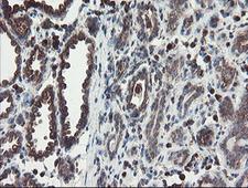 GCP60 / ACBD3 Antibody - IHC of paraffin-embedded Human breast tissue using anti-ACBD3 mouse monoclonal antibody.