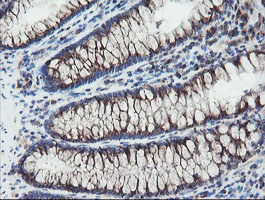 GCP60 / ACBD3 Antibody - IHC of paraffin-embedded Human colon tissue using anti-ACBD3 mouse monoclonal antibody.