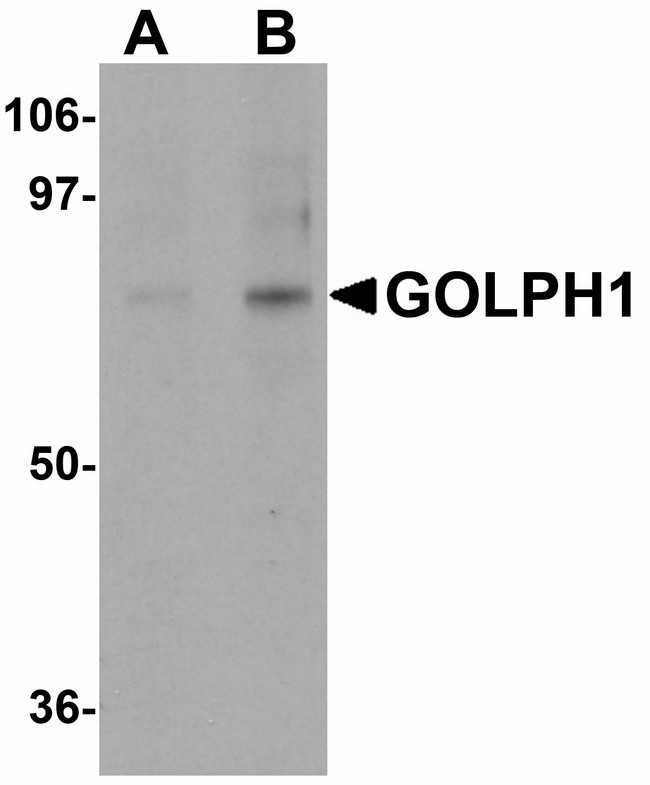 GCP60 / ACBD3 Antibody - Western blot of GOLPH1 in K562 cell lysate with GOLPH1 antibody at (A) 1 and (B) 2 ug/ml.