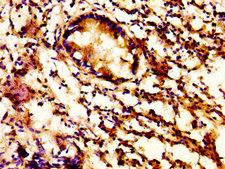 GCP60 / ACBD3 Antibody - Immunohistochemistry image at a dilution of 1:500 and staining in paraffin-embedded human appendix tissue performed on a Leica BondTM system. After dewaxing and hydration, antigen retrieval was mediated by high pressure in a citrate buffer (pH 6.0) . Section was blocked with 10% normal goat serum 30min at RT. Then primary antibody (1% BSA) was incubated at 4 °C overnight. The primary is detected by a biotinylated secondary antibody and visualized using an HRP conjugated SP system.