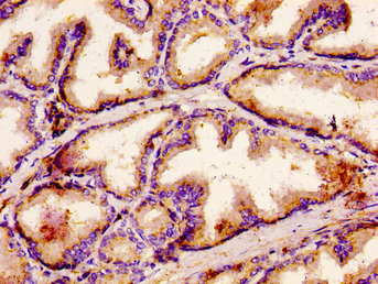 GCP60 / ACBD3 Antibody - Immunohistochemistry image at a dilution of 1:500 and staining in paraffin-embeddedhuman prostate tissue performed on a Leica BondTM system. After dewaxing and hydration, antigen retrieval was mediated by high pressure in a citrate buffer (pH 6.0) . Section was blocked with 10% normal goat serum 30min at RT. Then primary antibody (1% BSA) was incubated at 4 °C overnight. The primary is detected by a biotinylated secondary antibody and visualized using an HRP conjugated ABC system.