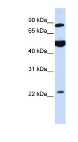 GCS1 / MOGS Antibody - MOGS / GCS1 antibody Western blot of HeLa lysate. This image was taken for the unconjugated form of this product. Other forms have not been tested.