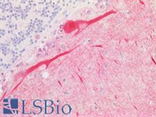 GCS1 / MOGS Antibody - Human Brain, Cerebellum Purkinje Cells : Formalin-Fixed, Paraffin-Embedded (FFPE)