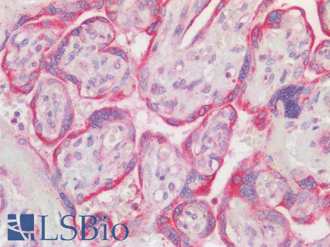 GCS1 / MOGS Antibody - Human Placenta, Trophoblasts: Formalin-Fixed, Paraffin-Embedded (FFPE)